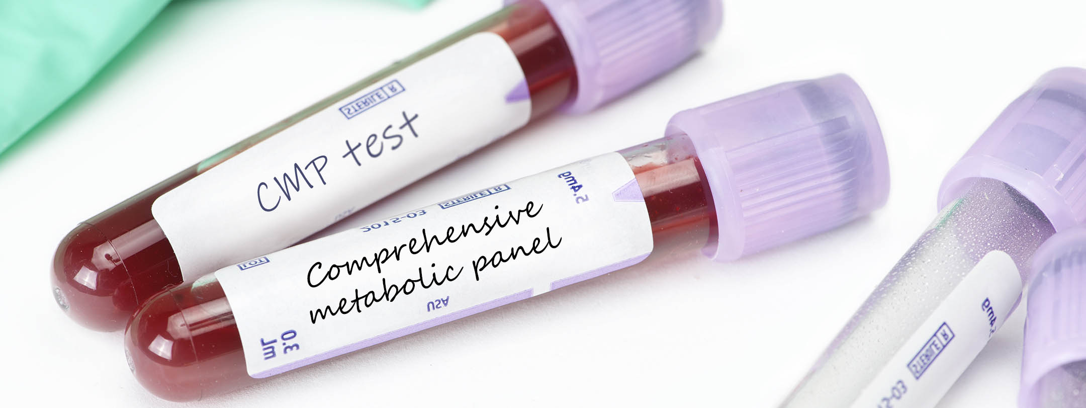 comprehensive metabolic panel