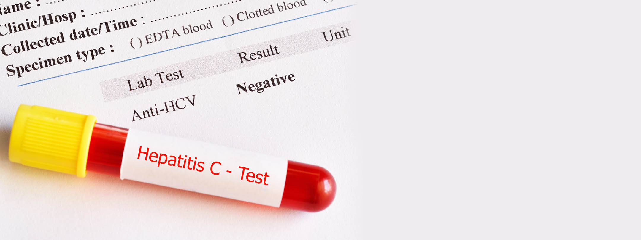 Hepatitis C Antibodies (antiHCV) VisitHealth