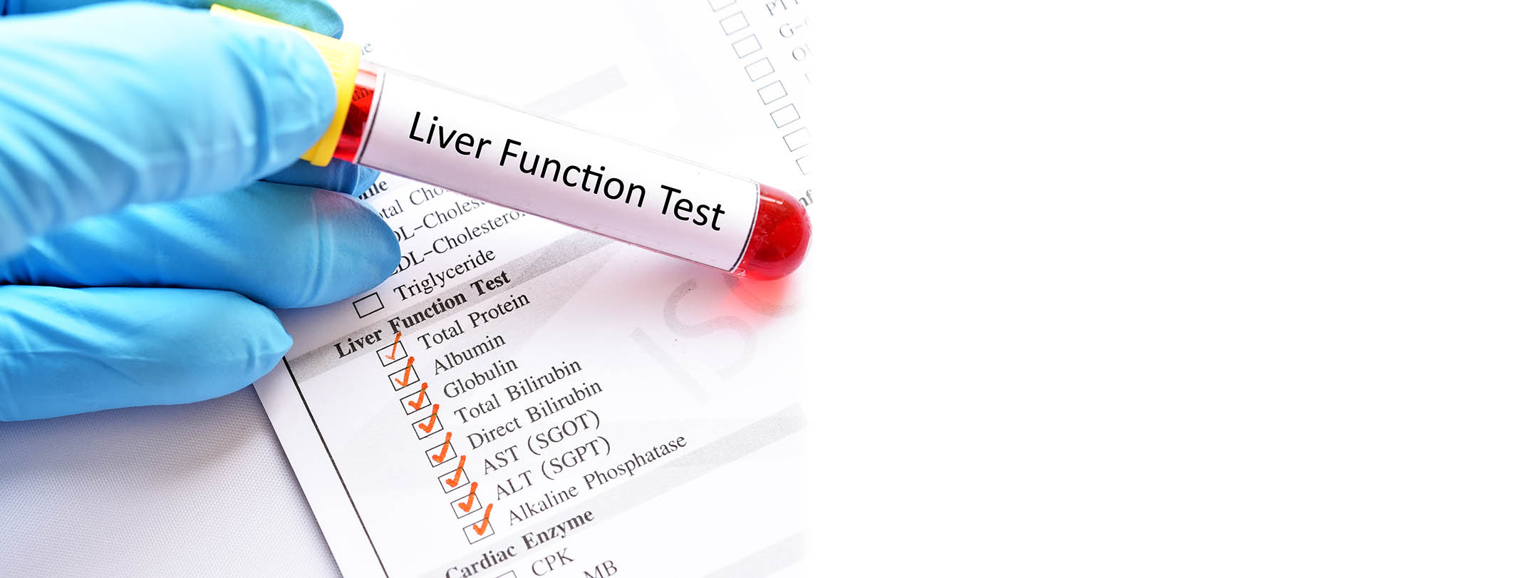 Liver Function Tests Lft Visithealth