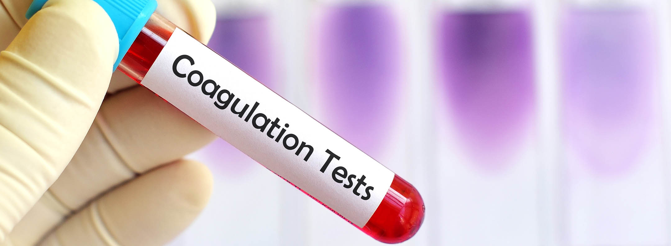 Coagulation Test