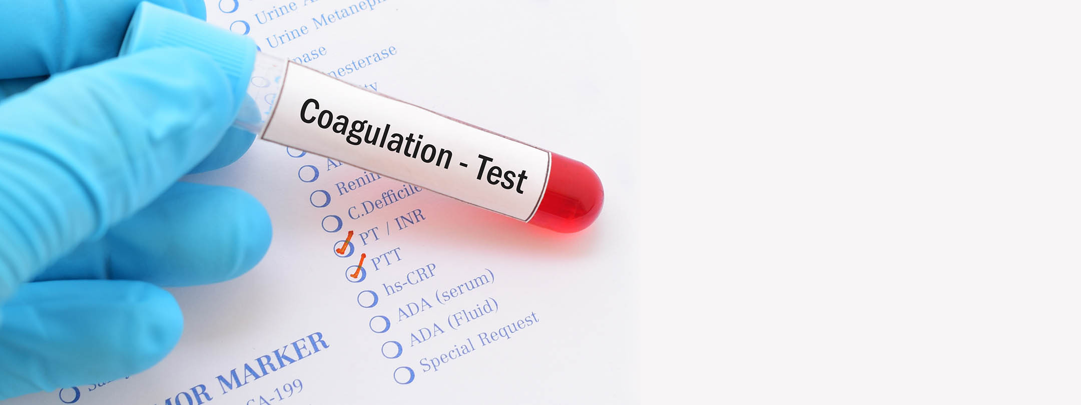 C test. Hba1c. HBA тест. Coagulation Blood Tests. Измерение hba1c.