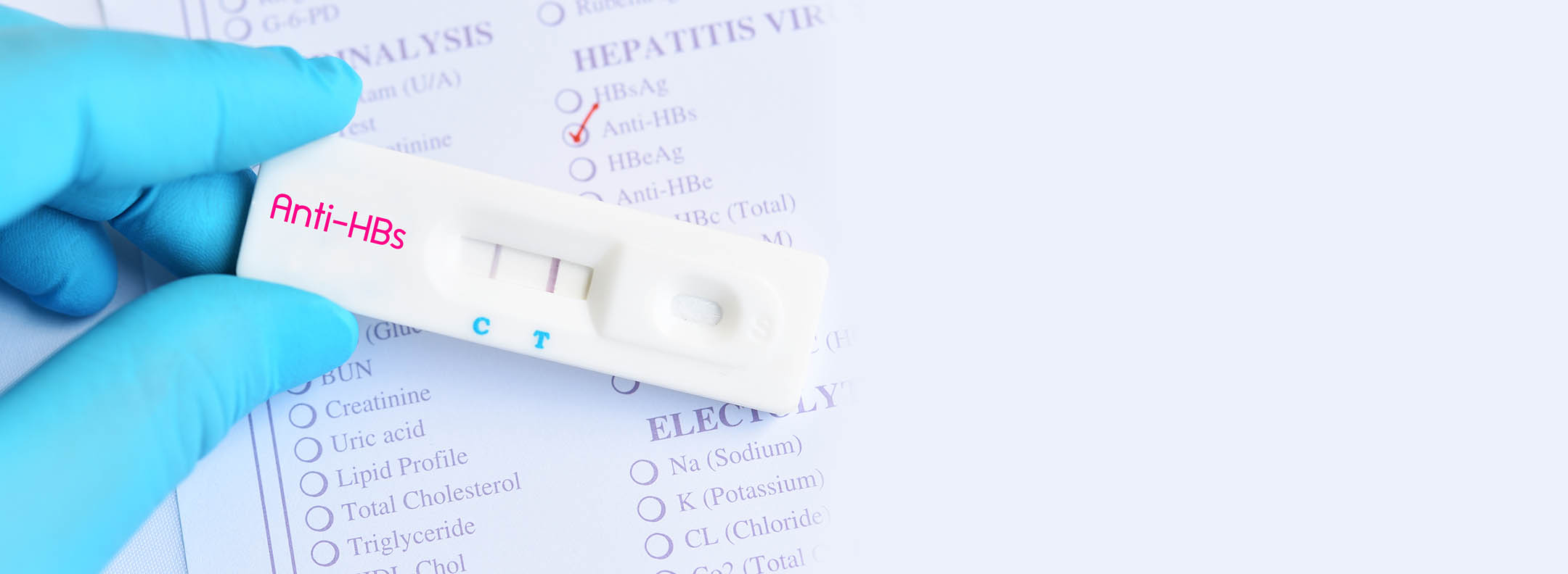 Hepatitis B Immunity (antiHBs, HBsAb) VisitHealth