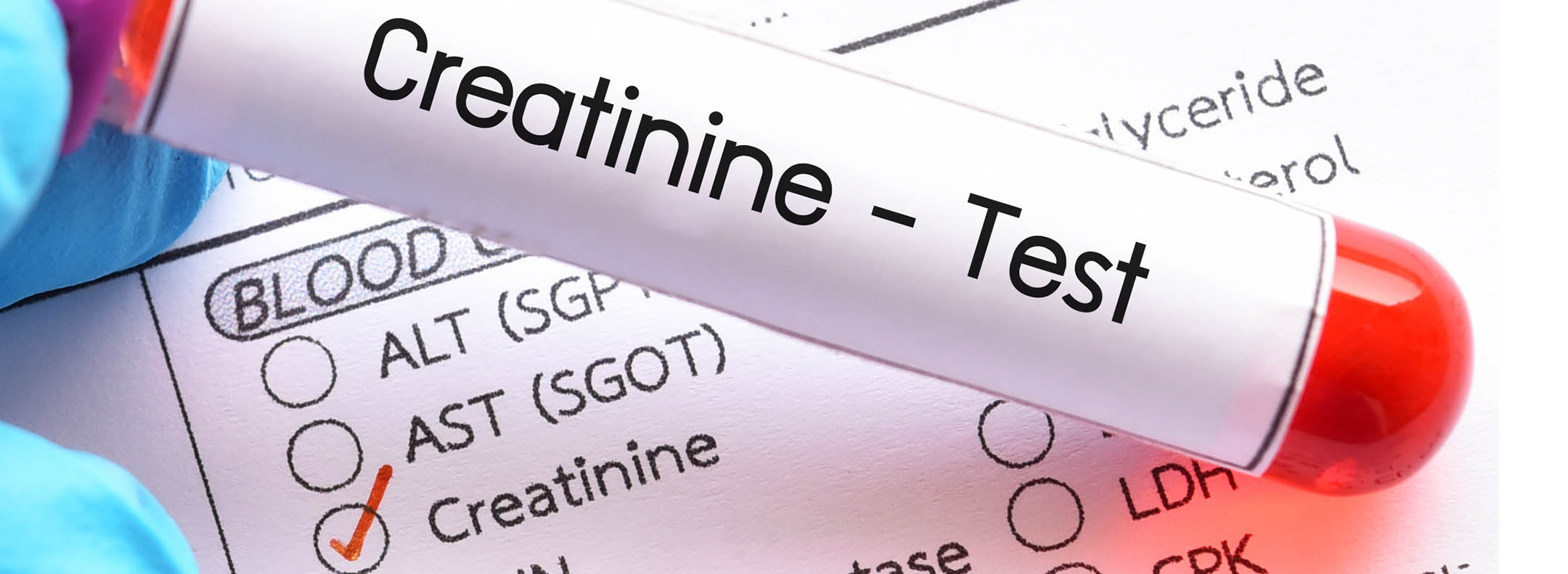 Creatinine | VisitHealth